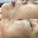 샤인피부관리실 이미지