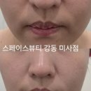 서로에스테틱 네이버블로그