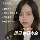 마크성형외과의원 이미지