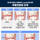 올바로 이미지