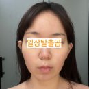 남천동피부관리 뷰티멘떼 피부의 시간을 되돌려 주는 공간 리프팅재생관리 후기