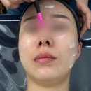 대전 관저동 피부관리, 대전예신관리로 딱인 3배빠른윤곽관리 받고온 퀸비 대전점