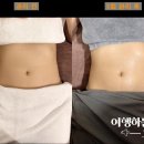 대구수성구에스테틱 1회만으로도 효과가 있었던 체형관리 전문 예쁘디온