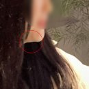 GS25 장흥병원점 | 신상성형외과 이중턱 지방흡입 후기 :: 상담부터 수술 당일 4일차 내돈내산 기록(1편)