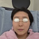 엄마손한의원 | 창원대방동 엄마손한의원 퓨라셀 레이저 시술 후기