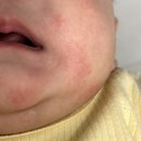 유빈약국 | 비판텐 약국 가격 침독 기저귀발진 사용후기