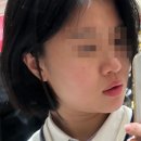 영통한의원 | 영통역한의원 엑소좀주사 라보센 스킨부스터 통증 효과 후기