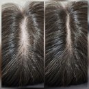 산정 | 탈모약 미녹산정 37.5 내돈내산 후기