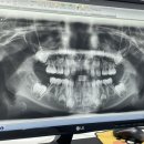 서울주니어스치과의원 이미지