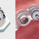 ONE DENTAL 이미지