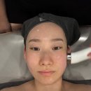 역삼동 신논현 피부관리 리엔에스테틱 물광테라피 후기