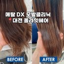 준메디칼 | 대전 관평동 손상모발케어 메탈 DX 모발클리닉 추천 후기 : 올라잇헤어 (비포,애프터 사진)