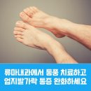 위너스메드 | &#39;엄지발가락 밑 통증 통풍이 의심된다면 꼭 확인해보세요!&#39; [통풍 치료 병의원]