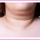 혹부리한의원 이미지