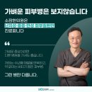 얼굴붉은반점 각질 가려움까지 일어난다면 지금 보세요