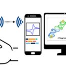 메디트론 이미지