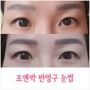 조앤박의원 | 눈썹 반영구는 조앤박에서