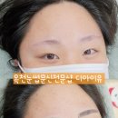 엠보디아 네이버블로그