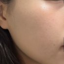 수분 장벽 미백 주름개선 기능성 세럼 렘부떼 타마린드 브라이트닝 세럼 실제 사용 후기