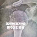 석회화건염 어깨통증 석회제거 수술후기 원주 성지병원(수술사진포함)