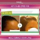 더헤어라인성형외과의원 이미지