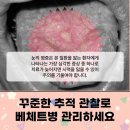 성모류마내과의원 | 강서구 류마내과 의원 류마티스내과 진료를 고려한다면?