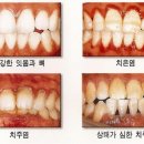 주안서울치과 네이버블로그