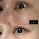 광주 피부관리샵 라윤더뷰티 물방울 관리 솔직후기