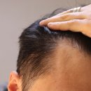 비오메디 | 메디퍼블릭 비오티아민 남성헤어 영양제 왜 필요할까