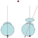 양안시(binocular vision)와 사위(phoria) 이미지