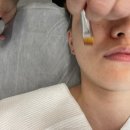무아 플레이스 강남 피부관리 스킨플래닝 플라즈마