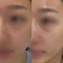 프롬미(From Me) | [대전 프롬미 피부관리 에스테틱] 수분바이오힐 관리 후기 완전 추천합니당
