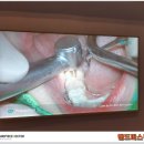 핸드피스닥터 이미지