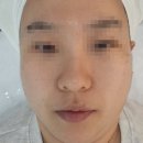 영인산성 | 별내 유와왁싱에서 스킨플래닝 받고 온 후기