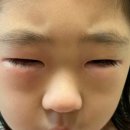 아로마홈힐러 이미지