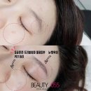 봉곡동337 | 창원상남동뷰티055 눈썹왁싱하고 PDT케어 받아써용