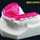 스타치과기공소 이미지