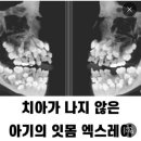 태어날때부터 유치 영구치 다 갖고있는게 ㅈㄴ신기하다.. 이미지