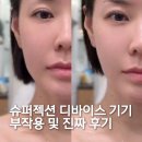 리:쥬뷰티 | 물방울 리프팅기기 슈퍼젝션 디바이스 부작용과 후기