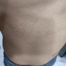 기연약품 | 탈모 10년차 남자 탈모약 민간요법 사용후기