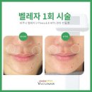 이지스킨by.엘