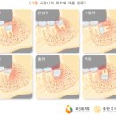 올스마일치과 Daum카페
