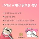 멍크라운 이미지