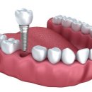 365석치과의원 이미지