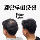 (주)달인과사람들 | 검단두피문신 탈모달인의 실제후기 자연스러운 밀도보강