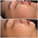 씨유대전유천스타점 | 대전 피부관리 만족도 높았던 212네일뷰티&amp;푸스대전유천점 케어 후기