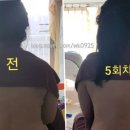 위더스산후케어