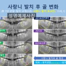 웃는E치과교정과치과의원 네이버블로그