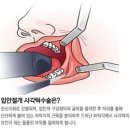 턱수술과 양악수술의 차이.gif 이미지