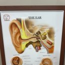 밝은보청기 이미지